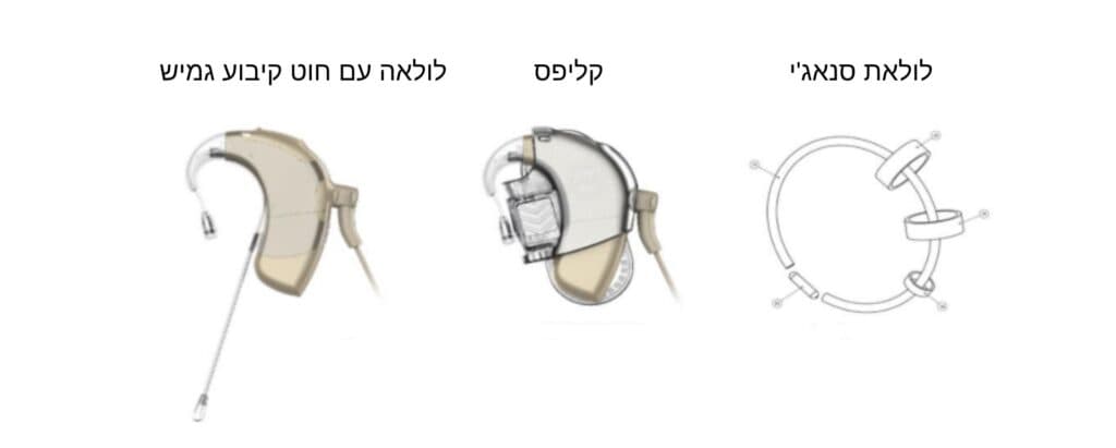 פתרונות לקיבוע מרוול לאתר